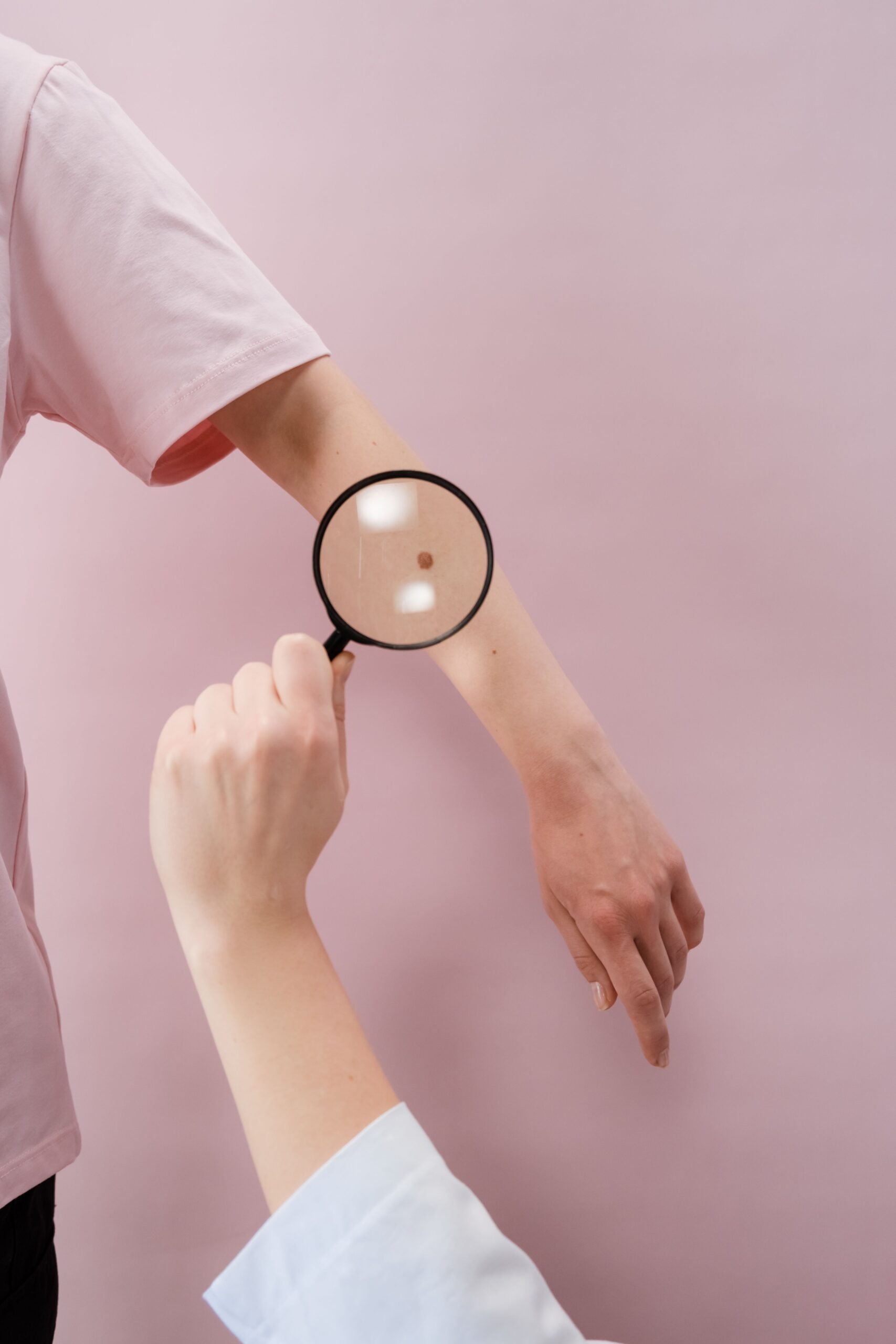 Magnifying glass examining a mole on skin, illustrating the ABCDE skin cancer warning signs